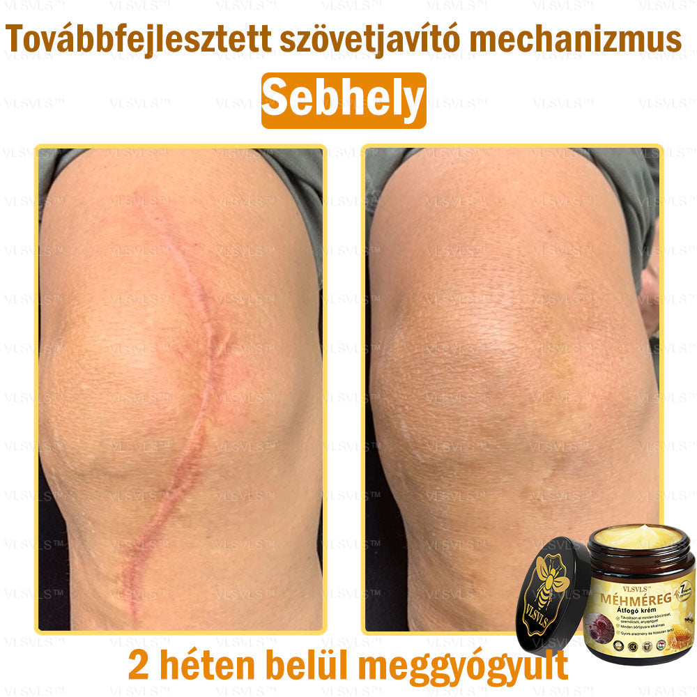 VLSVLS™ Méhméreg Átfogó Krém (Minden korosztály számára alkalmas & HSME ajánlja)👍✅✅✅