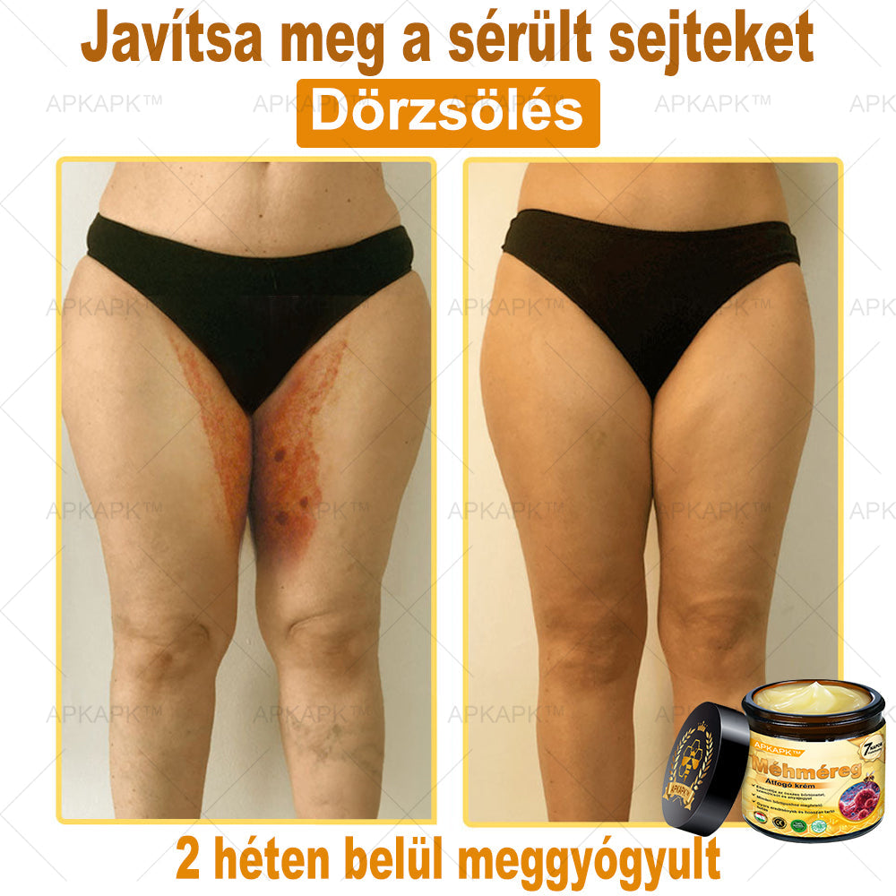 𝐀𝐏𝐊𝐀𝐏𝐊™ 𝐌É𝐇𝐌É𝐑𝐄𝐆 Á𝐓𝐅𝐎𝐆Ó 𝐊𝐑É𝐌🥇𝐀 𝐛ö𝐫𝐩𝐫𝐨𝐛𝐥é𝐦á𝐤 𝐤𝐞𝐳𝐞𝐥é𝐬𝐞 𝐦𝐚𝐠á𝐛𝐚𝐧 𝐟𝐨𝐠𝐥𝐚𝐥𝐣𝐚: é𝐥𝐞𝐭𝐤𝐨𝐫𝐢 𝐟𝐨𝐥𝐭𝐨𝐤, 𝐡𝐞𝐠𝐞𝐤, 𝐬𝐳𝐞𝐦ö𝐥𝐜𝐬ö𝐤, 𝐛ö𝐫𝐧ö𝐯𝐞𝐝é𝐤𝐞𝐤, 𝐭á𝐥𝐲𝐨𝐠𝐨𝐤, 𝐩𝐚𝐭𝐭𝐚𝐧á𝐬𝐨𝐤, 𝐞𝐤𝐜é𝐦𝐚, 𝐩𝐬𝐨𝐫𝐢𝐚𝐬𝐢𝐬, 𝐚𝐜𝐧𝐞 𝐢𝐧𝐯𝐞𝐫𝐬𝐚, 𝐫á𝐧𝐜𝐨𝐤, 𝐛ö𝐫ö𝐫𝐞𝐠𝐞𝐝é𝐬 é𝐬 𝐞𝐠𝐲é𝐛 𝐩𝐫𝐨𝐛𝐥é𝐦á𝐤🔥