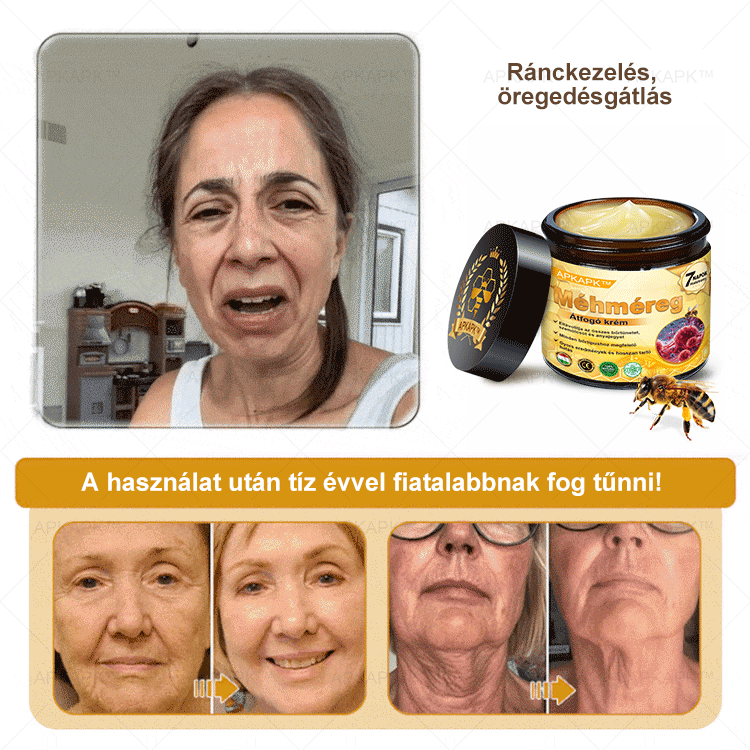 𝐀𝐏𝐊𝐀𝐏𝐊™ 𝐌É𝐇𝐌É𝐑𝐄𝐆 Á𝐓𝐅𝐎𝐆Ó 𝐊𝐑É𝐌🥇𝐀 𝐛ö𝐫𝐩𝐫𝐨𝐛𝐥é𝐦á𝐤 𝐤𝐞𝐳𝐞𝐥é𝐬𝐞 𝐦𝐚𝐠á𝐛𝐚𝐧 𝐟𝐨𝐠𝐥𝐚𝐥𝐣𝐚: é𝐥𝐞𝐭𝐤𝐨𝐫𝐢 𝐟𝐨𝐥𝐭𝐨𝐤, 𝐡𝐞𝐠𝐞𝐤, 𝐬𝐳𝐞𝐦ö𝐥𝐜𝐬ö𝐤, 𝐛ö𝐫𝐧ö𝐯𝐞𝐝é𝐤𝐞𝐤, 𝐭á𝐥𝐲𝐨𝐠𝐨𝐤, 𝐩𝐚𝐭𝐭𝐚𝐧á𝐬𝐨𝐤, 𝐞𝐤𝐜é𝐦𝐚, 𝐩𝐬𝐨𝐫𝐢𝐚𝐬𝐢𝐬, 𝐚𝐜𝐧𝐞 𝐢𝐧𝐯𝐞𝐫𝐬𝐚, 𝐫á𝐧𝐜𝐨𝐤, 𝐛ö𝐫ö𝐫𝐞𝐠𝐞𝐝é𝐬 é𝐬 𝐞𝐠𝐲é𝐛 𝐩𝐫𝐨𝐛𝐥é𝐦á𝐤🔥