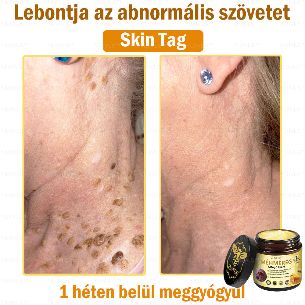 VLSVLS™ Méhméreg Átfogó Krém (Minden korosztály számára alkalmas & HSME ajánlja)👍✅✅✅