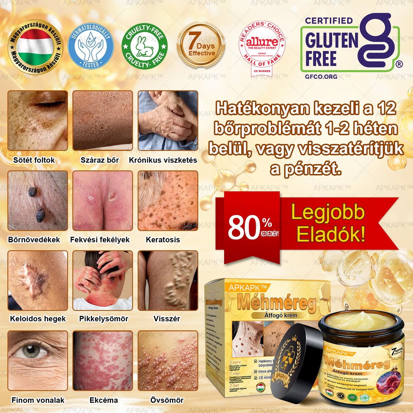𝐀𝐏𝐊𝐀𝐏𝐊™ 𝐌É𝐇𝐌É𝐑𝐄𝐆 Á𝐓𝐅𝐎𝐆Ó 𝐊𝐑É𝐌🥇𝐀 𝐛ö𝐫𝐩𝐫𝐨𝐛𝐥é𝐦á𝐤 𝐤𝐞𝐳𝐞𝐥é𝐬𝐞 𝐦𝐚𝐠á𝐛𝐚𝐧 𝐟𝐨𝐠𝐥𝐚𝐥𝐣𝐚: é𝐥𝐞𝐭𝐤𝐨𝐫𝐢 𝐟𝐨𝐥𝐭𝐨𝐤, 𝐡𝐞𝐠𝐞𝐤, 𝐬𝐳𝐞𝐦ö𝐥𝐜𝐬ö𝐤, 𝐛ö𝐫𝐧ö𝐯𝐞𝐝é𝐤𝐞𝐤, 𝐭á𝐥𝐲𝐨𝐠𝐨𝐤, 𝐩𝐚𝐭𝐭𝐚𝐧á𝐬𝐨𝐤, 𝐞𝐤𝐜é𝐦𝐚, 𝐩𝐬𝐨𝐫𝐢𝐚𝐬𝐢𝐬, 𝐚𝐜𝐧𝐞 𝐢𝐧𝐯𝐞𝐫𝐬𝐚, 𝐫á𝐧𝐜𝐨𝐤, 𝐛ö𝐫ö𝐫𝐞𝐠𝐞𝐝é𝐬 é𝐬 𝐞𝐠𝐲é𝐛 𝐩𝐫𝐨𝐛𝐥é𝐦á𝐤🔥