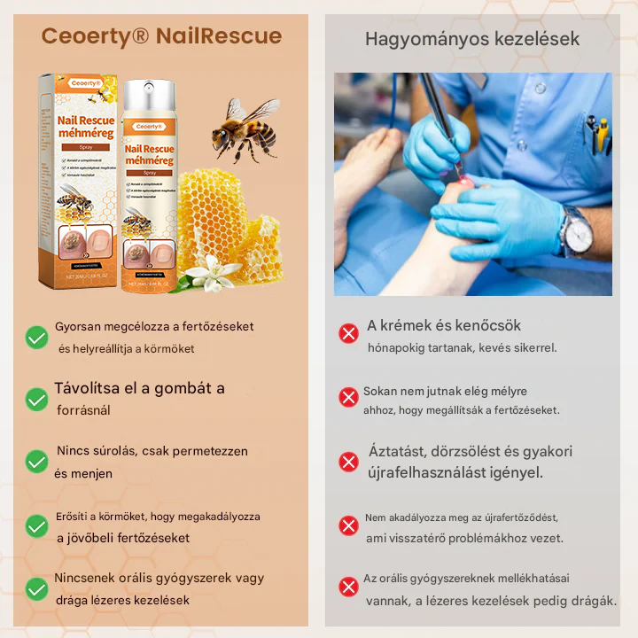 💥 2025 Korlátozott 70% KEDVEZMÉNY ️⏳ Ceoerty® NailRescue Kolirin méhméreg körömgomba spray 💥 Minden körömproblémát orvosolhatsz 2 héten belül💥