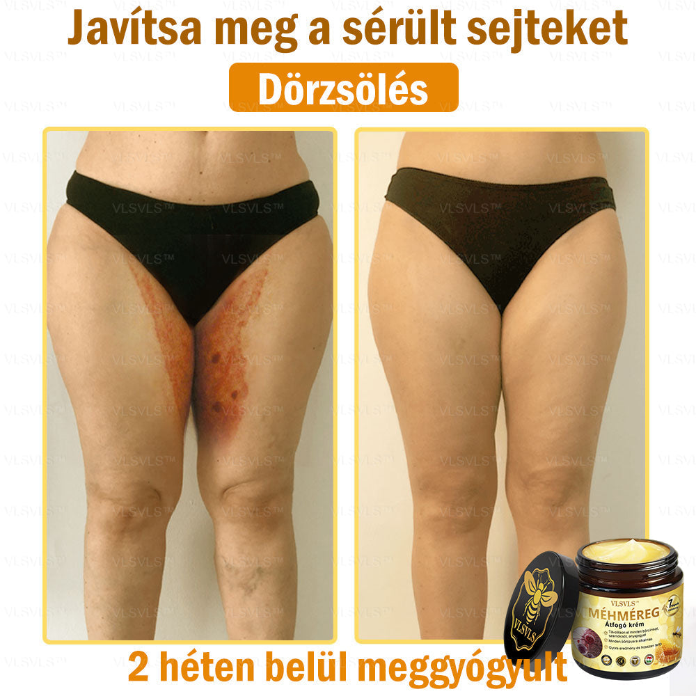 VLSVLS™ Méhméreg Átfogó Krém (Minden korosztály számára alkalmas & HSME ajánlja)👍✅✅✅