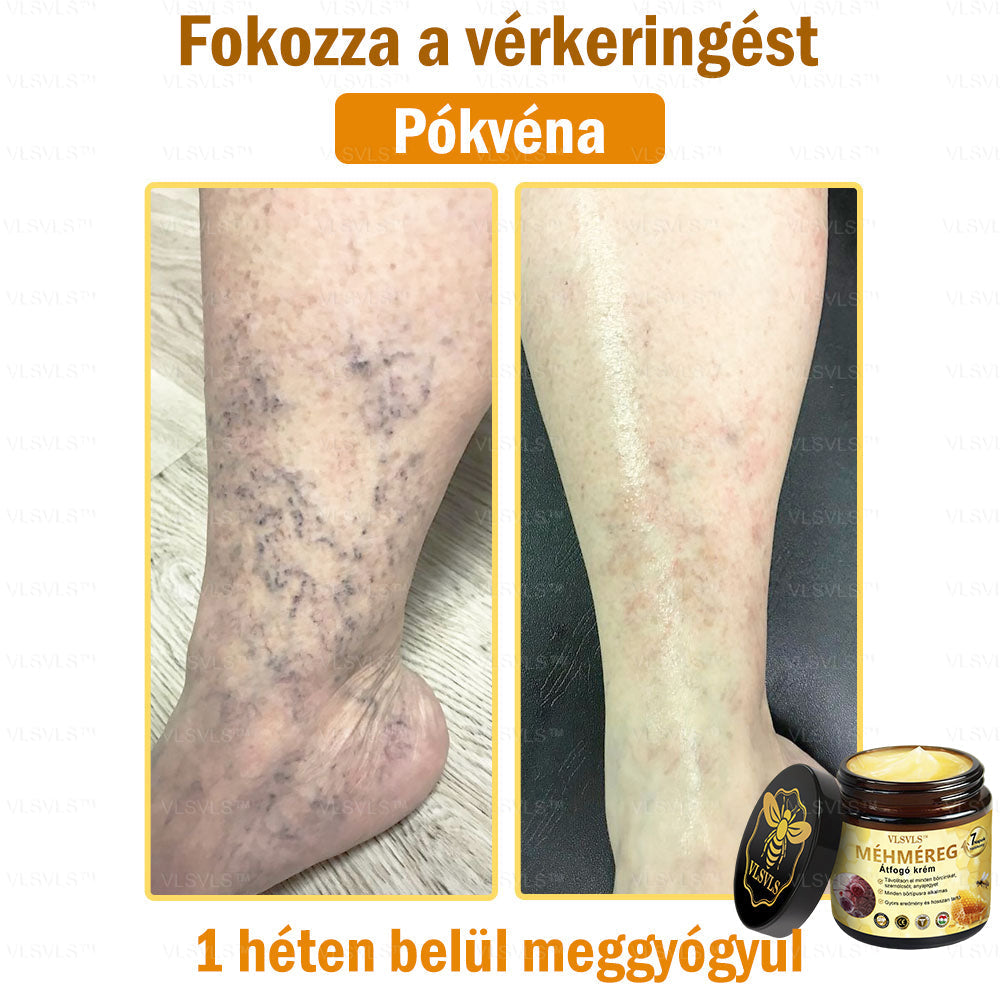 VLSVLS™ Méhméreg Átfogó Krém (Minden korosztály számára alkalmas & HSME ajánlja)👍✅✅✅