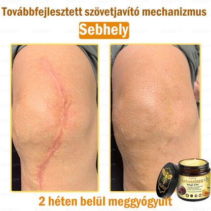 VLSVLS™ Méhméreg Átfogó Krém (Minden korosztály számára alkalmas & HSME ajánlja)👍✅✅✅
