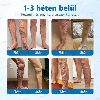 💚Trimil® VeinGuard Gyógynövényes Spray - ✅ Klinikailag bizonyított, hogy mindössze 7 nap alatt megszünteti a visszereket!💚💚💚