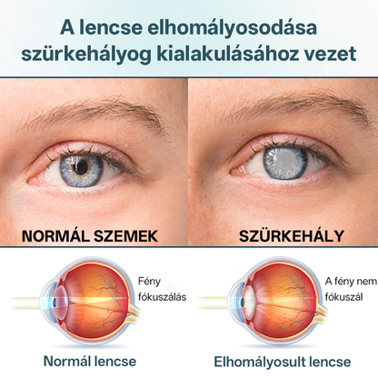 Timilk® OptiFusion Nano szemcsepp szérum🎉🎉🎉