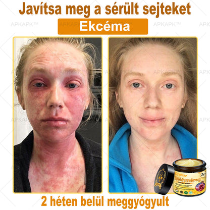 𝐀𝐏𝐊𝐀𝐏𝐊™ 𝐌É𝐇𝐌É𝐑𝐄𝐆 Á𝐓𝐅𝐎𝐆Ó 𝐊𝐑É𝐌🥇𝐀 𝐛ö𝐫𝐩𝐫𝐨𝐛𝐥é𝐦á𝐤 𝐤𝐞𝐳𝐞𝐥é𝐬𝐞 𝐦𝐚𝐠á𝐛𝐚𝐧 𝐟𝐨𝐠𝐥𝐚𝐥𝐣𝐚: é𝐥𝐞𝐭𝐤𝐨𝐫𝐢 𝐟𝐨𝐥𝐭𝐨𝐤, 𝐡𝐞𝐠𝐞𝐤, 𝐬𝐳𝐞𝐦ö𝐥𝐜𝐬ö𝐤, 𝐛ö𝐫𝐧ö𝐯𝐞𝐝é𝐤𝐞𝐤, 𝐭á𝐥𝐲𝐨𝐠𝐨𝐤, 𝐩𝐚𝐭𝐭𝐚𝐧á𝐬𝐨𝐤, 𝐞𝐤𝐜é𝐦𝐚, 𝐩𝐬𝐨𝐫𝐢𝐚𝐬𝐢𝐬, 𝐚𝐜𝐧𝐞 𝐢𝐧𝐯𝐞𝐫𝐬𝐚, 𝐫á𝐧𝐜𝐨𝐤, 𝐛ö𝐫ö𝐫𝐞𝐠𝐞𝐝é𝐬 é𝐬 𝐞𝐠𝐲é𝐛 𝐩𝐫𝐨𝐛𝐥é𝐦á𝐤🔥