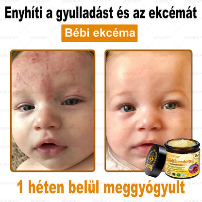 𝐀𝐏𝐊𝐀𝐏𝐊™ 𝐌É𝐇𝐌É𝐑𝐄𝐆 Á𝐓𝐅𝐎𝐆Ó 𝐊𝐑É𝐌🥇𝐀 𝐛ö𝐫𝐩𝐫𝐨𝐛𝐥é𝐦á𝐤 𝐤𝐞𝐳𝐞𝐥é𝐬𝐞 𝐦𝐚𝐠á𝐛𝐚𝐧 𝐟𝐨𝐠𝐥𝐚𝐥𝐣𝐚: é𝐥𝐞𝐭𝐤𝐨𝐫𝐢 𝐟𝐨𝐥𝐭𝐨𝐤, 𝐡𝐞𝐠𝐞𝐤, 𝐬𝐳𝐞𝐦ö𝐥𝐜𝐬ö𝐤, 𝐛ö𝐫𝐧ö𝐯𝐞𝐝é𝐤𝐞𝐤, 𝐭á𝐥𝐲𝐨𝐠𝐨𝐤, 𝐩𝐚𝐭𝐭𝐚𝐧á𝐬𝐨𝐤, 𝐞𝐤𝐜é𝐦𝐚, 𝐩𝐬𝐨𝐫𝐢𝐚𝐬𝐢𝐬, 𝐚𝐜𝐧𝐞 𝐢𝐧𝐯𝐞𝐫𝐬𝐚, 𝐫á𝐧𝐜𝐨𝐤, 𝐛ö𝐫ö𝐫𝐞𝐠𝐞𝐝é𝐬 é𝐬 𝐞𝐠𝐲é𝐛 𝐩𝐫𝐨𝐛𝐥é𝐦á𝐤🔥