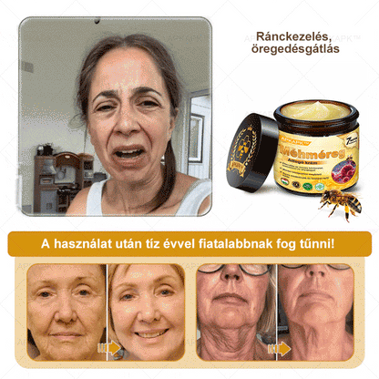 𝐀𝐏𝐊𝐀𝐏𝐊™ 𝐌É𝐇𝐌É𝐑𝐄𝐆 Á𝐓𝐅𝐎𝐆Ó 𝐊𝐑É𝐌🥇𝐀 𝐛ö𝐫𝐩𝐫𝐨𝐛𝐥é𝐦á𝐤 𝐤𝐞𝐳𝐞𝐥é𝐬𝐞 𝐦𝐚𝐠á𝐛𝐚𝐧 𝐟𝐨𝐠𝐥𝐚𝐥𝐣𝐚: é𝐥𝐞𝐭𝐤𝐨𝐫𝐢 𝐟𝐨𝐥𝐭𝐨𝐤, 𝐡𝐞𝐠𝐞𝐤, 𝐬𝐳𝐞𝐦ö𝐥𝐜𝐬ö𝐤, 𝐛ö𝐫𝐧ö𝐯𝐞𝐝é𝐤𝐞𝐤, 𝐭á𝐥𝐲𝐨𝐠𝐨𝐤, 𝐩𝐚𝐭𝐭𝐚𝐧á𝐬𝐨𝐤, 𝐞𝐤𝐜é𝐦𝐚, 𝐩𝐬𝐨𝐫𝐢𝐚𝐬𝐢𝐬, 𝐚𝐜𝐧𝐞 𝐢𝐧𝐯𝐞𝐫𝐬𝐚, 𝐫á𝐧𝐜𝐨𝐤, 𝐛ö𝐫ö𝐫𝐞𝐠𝐞𝐝é𝐬 é𝐬 𝐞𝐠𝐲é𝐛 𝐩𝐫𝐨𝐛𝐥é𝐦á𝐤🔥