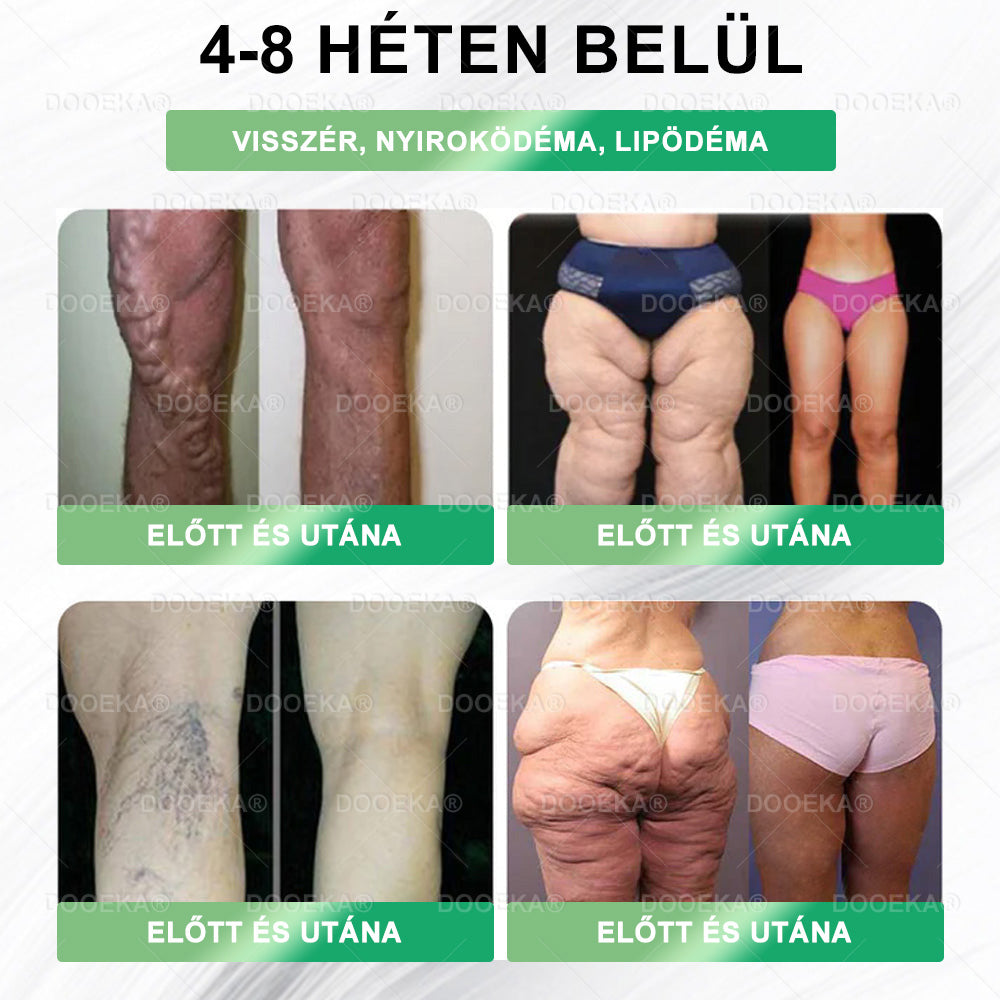 💖💖  DOOEKA® GLP-1 8 az 1-ben Fit & Vital Szájon át szedhető oldat – 👨‍⚕️ Napi egyszer, 7 nap alatt látható változás / Elhízás, szív- és érrendszeri egészség, cukorbetegség, alvási apnoe, bélrendszer egészsége, ízületi problémák és még sok más esetén💖💖