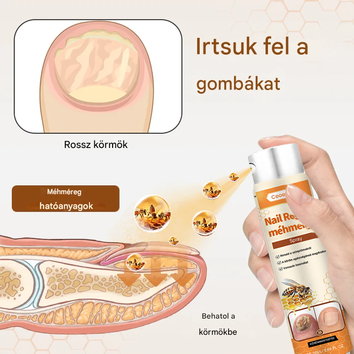 💥 2025 Korlátozott 70% KEDVEZMÉNY ️⏳ Ceoerty® NailRescue Kolirin méhméreg körömgomba spray 💥 Minden körömproblémát orvosolhatsz 2 héten belül💥