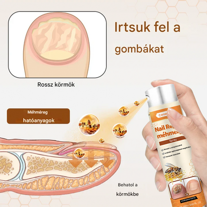 💥 2025 Korlátozott 70% KEDVEZMÉNY ️⏳ Ceoerty® NailRescue Kolirin méhméreg körömgomba spray 💥 Minden körömproblémát orvosolhatsz 2 héten belül💥