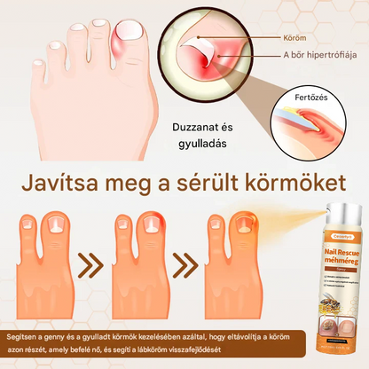 💥 2025 Korlátozott 70% KEDVEZMÉNY ️⏳ Ceoerty® NailRescue Kolirin méhméreg körömgomba spray 💥 Minden körömproblémát orvosolhatsz 2 héten belül💥