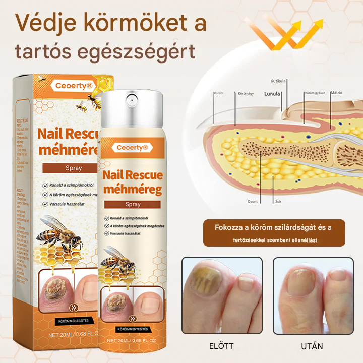 💥 2025 Korlátozott 70% KEDVEZMÉNY ️⏳ Ceoerty® NailRescue Kolirin méhméreg körömgomba spray 💥 Minden körömproblémát orvosolhatsz 2 héten belül💥