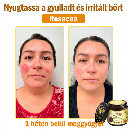 VLSVLS™ Méhméreg Átfogó Krém (Minden korosztály számára alkalmas & HSME ajánlja)👍✅