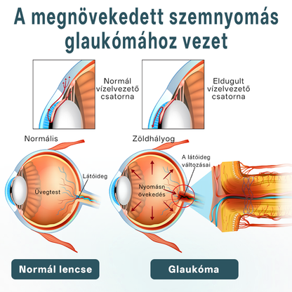 Timilk® OptiFusion Nano szemcsepp szérum🎉🎉🎉