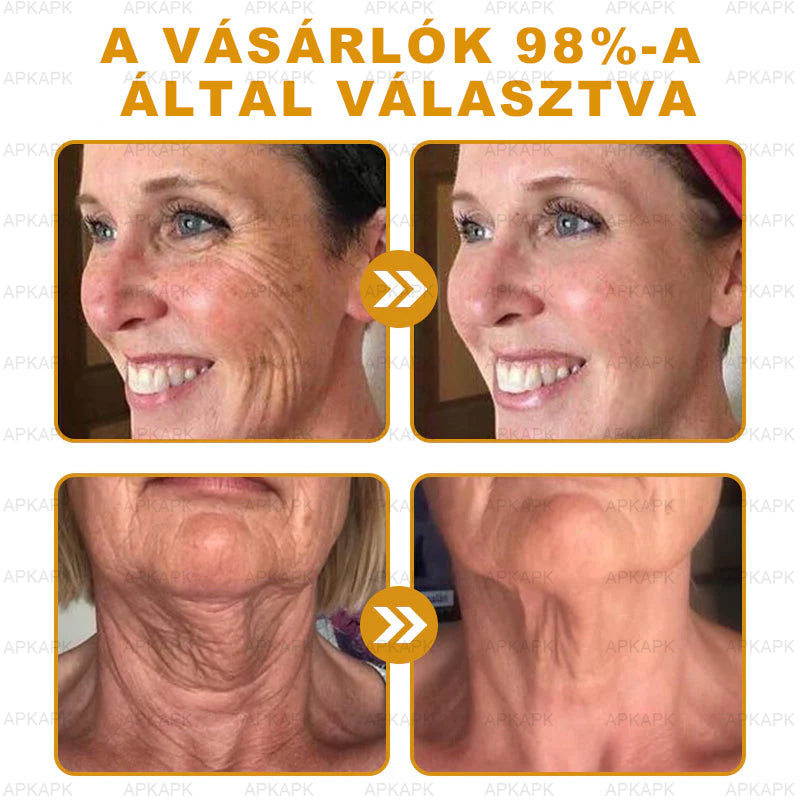 𝐀𝐏𝐊𝐀𝐏𝐊™ 𝐌É𝐇𝐌É𝐑𝐄𝐆 Á𝐓𝐅𝐎𝐆Ó 𝐊𝐑É𝐌🥇𝐀 𝐛ö𝐫𝐩𝐫𝐨𝐛𝐥é𝐦á𝐤 𝐤𝐞𝐳𝐞𝐥é𝐬𝐞 𝐦𝐚𝐠á𝐛𝐚𝐧 𝐟𝐨𝐠𝐥𝐚𝐥𝐣𝐚: é𝐥𝐞𝐭𝐤𝐨𝐫𝐢 𝐟𝐨𝐥𝐭𝐨𝐤, 𝐡𝐞𝐠𝐞𝐤, 𝐬𝐳𝐞𝐦ö𝐥𝐜𝐬ö𝐤, 𝐛ö𝐫𝐧ö𝐯𝐞𝐝é𝐤𝐞𝐤, 𝐭á𝐥𝐲𝐨𝐠𝐨𝐤, 𝐩𝐚𝐭𝐭𝐚𝐧á𝐬𝐨𝐤, 𝐞𝐤𝐜é𝐦𝐚, 𝐩𝐬𝐨𝐫𝐢𝐚𝐬𝐢𝐬, 𝐚𝐜𝐧𝐞 𝐢𝐧𝐯𝐞𝐫𝐬𝐚, 𝐫á𝐧𝐜𝐨𝐤, 𝐛ö𝐫ö𝐫𝐞𝐠𝐞𝐝é𝐬 é𝐬 𝐞𝐠𝐲é𝐛 𝐩𝐫𝐨𝐛𝐥é𝐦á𝐤🔥