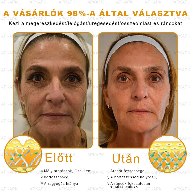 𝐀𝐏𝐊𝐀𝐏𝐊™ 𝐌É𝐇𝐌É𝐑𝐄𝐆 Á𝐓𝐅𝐎𝐆Ó 𝐊𝐑É𝐌🥇𝐀 𝐛ö𝐫𝐩𝐫𝐨𝐛𝐥é𝐦á𝐤 𝐤𝐞𝐳𝐞𝐥é𝐬𝐞 𝐦𝐚𝐠á𝐛𝐚𝐧 𝐟𝐨𝐠𝐥𝐚𝐥𝐣𝐚: é𝐥𝐞𝐭𝐤𝐨𝐫𝐢 𝐟𝐨𝐥𝐭𝐨𝐤, 𝐡𝐞𝐠𝐞𝐤, 𝐬𝐳𝐞𝐦ö𝐥𝐜𝐬ö𝐤, 𝐛ö𝐫𝐧ö𝐯𝐞𝐝é𝐤𝐞𝐤, 𝐭á𝐥𝐲𝐨𝐠𝐨𝐤, 𝐩𝐚𝐭𝐭𝐚𝐧á𝐬𝐨𝐤, 𝐞𝐤𝐜é𝐦𝐚, 𝐩𝐬𝐨𝐫𝐢𝐚𝐬𝐢𝐬, 𝐚𝐜𝐧𝐞 𝐢𝐧𝐯𝐞𝐫𝐬𝐚, 𝐫á𝐧𝐜𝐨𝐤, 𝐛ö𝐫ö𝐫𝐞𝐠𝐞𝐝é𝐬 é𝐬 𝐞𝐠𝐲é𝐛 𝐩𝐫𝐨𝐛𝐥é𝐦á𝐤🔥