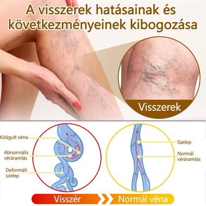 ✅flysmus™ méhméreg kezelő krém🐝: Ekcéma, pikkelysömör, akne, rosacea, gombás fertőzések, szemölcsök kezelése